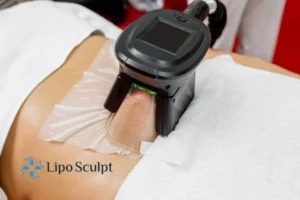 Are The Results From Aqualyx Permanent? 4 Compare Aqualyx South Ockendon to other fat reduction treatments.