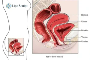 Treatment For A Leaky Bladder 2 How EM Chair treatment South Ockendon can help Leaky bladder issues. Read more now!