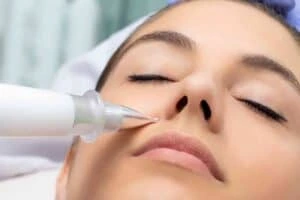 Best Actinic Keratoses Removal 3 Actinic keratoses South Ockendon solutions - book in today!