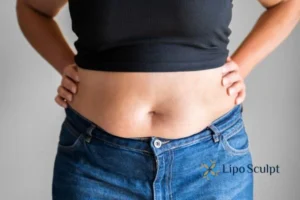 Bidding Farewell to Muffin Tops with Aqualyx Fat Injections 2 Do you wish you could reduce your muffin top South Ockendon With Aqualy fat dissolving injections you can!